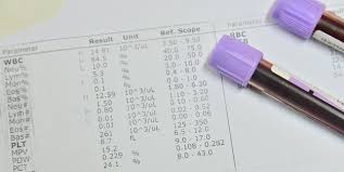 Kan Tahlilleri Hakkında Önemli Duyuru